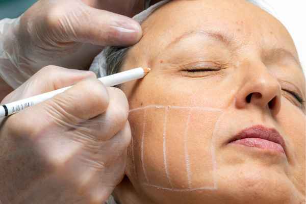 CryoPen: 5 Skin Concerns It May Be Used to Treat 4 What should you ask before having CryoPen treatment Nottingham?